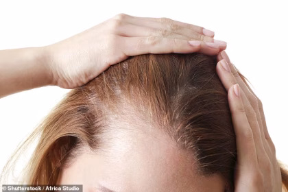 New study confirms link between fat jabs and hair loss, after thousands of users complained of shedding and bald patches