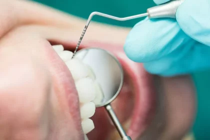 NHS dental appointments are free for specific people – full list explained