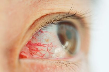 Teen, 19, ‘going blind’ after parasite enters eye while showering