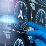 45p ‘superfood’ to eat to ward off dementia and for better skin