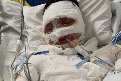 Teen fighting for life in hospital after being ‘doused in petrol and set alight’