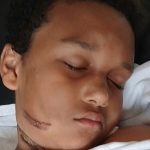 Boy, 9, recalls horror moment he almost died after charger caught fire in bed