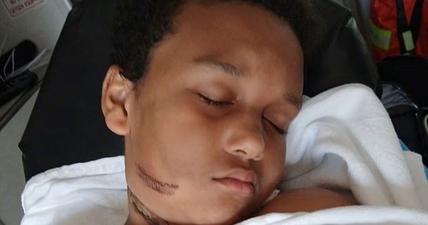 Boy, 9, recalls horror moment he almost died after charger caught fire in bed