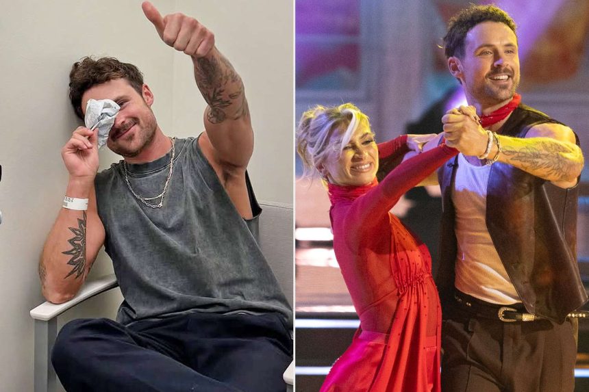 Dylan Efron Reveals He Broke His Nose During ‘DWTS’ Rehearsals