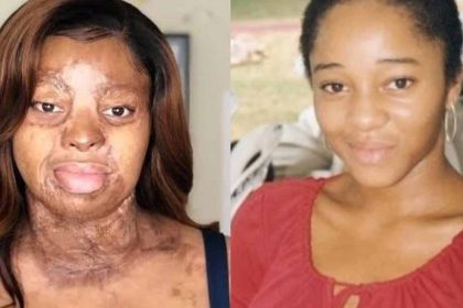 Sosoliso crash survivor Kechi Okwuchi celebrates 36th birthday with gratitude