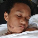 Boy Burned When Tablet Charger Got Caught in Metal Necklace, Mom Says (Exclusive)