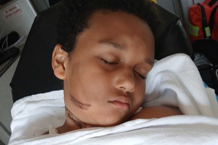 Boy Burned When Tablet Charger Got Caught in Metal Necklace, Mom Says (Exclusive)