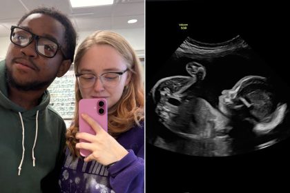 Pregnant Mom Says Ultrasound Clip Shows Baby’s ‘Spicy’ Personality (Exclusive)