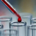 It’s Not “All in Your Head”: Scientists Develop Revolutionary Blood Test for Chronic Fatigue Syndrome