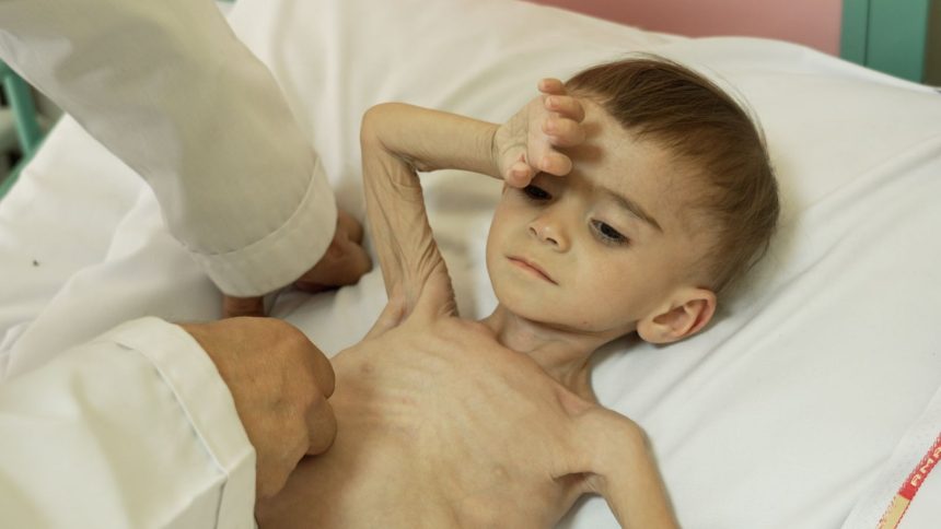 Crying babies dimmed by hunger fill this Afghanistan hospital – where parents fear each day might be the last | World News