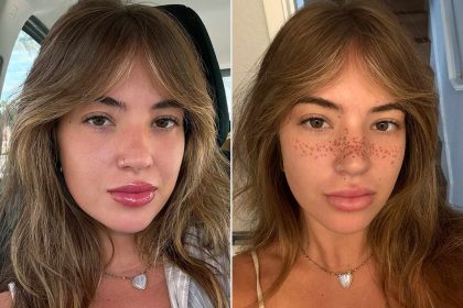 Internet Says Woman ‘Ruined’ Her Face by Getting Tattooed Freckles (Exclusive)