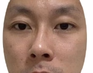 Can YOU tell which of these people are sick? Take the test to see if you can detect subtle signs of illness in faces