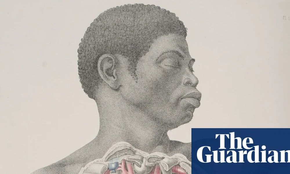 Anatomical exhibition includes rare Victorian-era drawing of a black body | Art