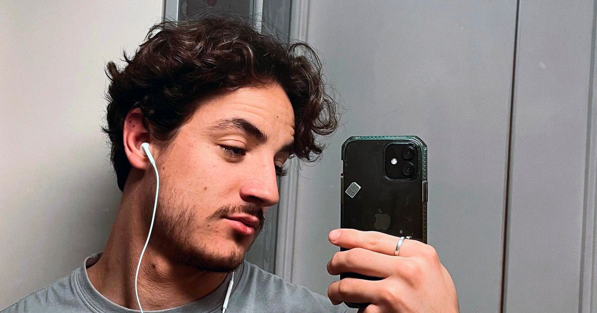 Student suffers tragic death after ‘botched beard transplant by estate agent’