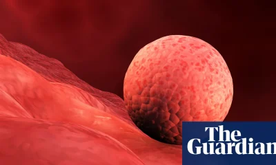 Scientists create replica human womb lining and implant early-stage embryos | Reproduction