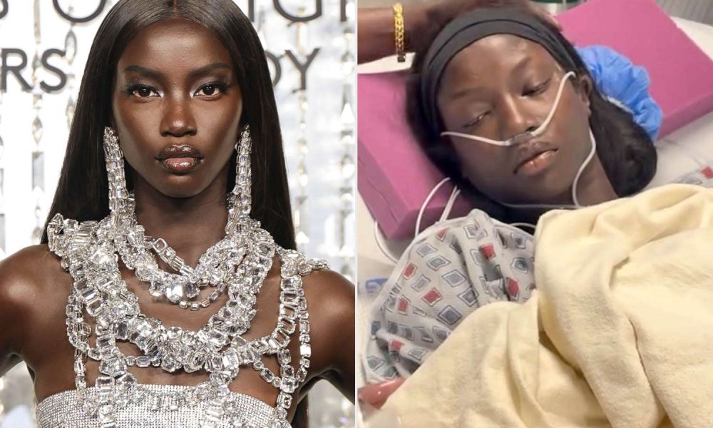 Model Anok Yai Diagnosed with ‘Congenital Defect’ That Was ‘Destroying’ Her Lungs