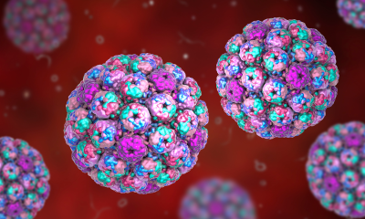 Widespread cold virus you’ve never heard of may play key role in bladder cancer