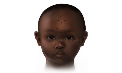 1,400 years ago, Nubians tattooed their toddlers. Archaeologists are trying to figure out why.