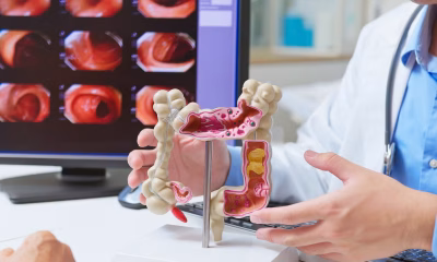 Six modifiable risk factors linked to almost half of cancer deaths