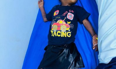 2-Year-Old Inayat Needs Help for N20m Heart Surgery in India – THISDAYLIVE